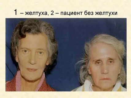 Бледно желтый цвет кожи