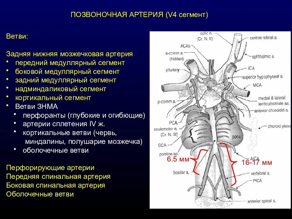 Сегменты v1 v2 позвоночных артерий. Сегменты позвоночной артерии v4 мрт. Сегменты позвоночной артерии v5 схема. Сегменты v3 v4 позвоночной артерии.