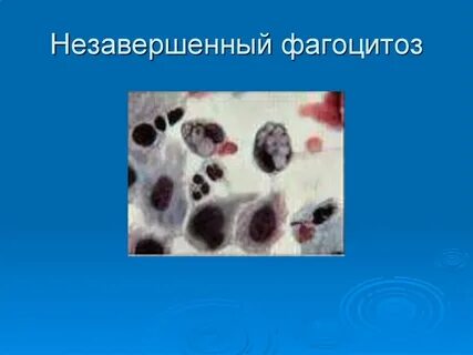 В основе лежит фагоцитоз