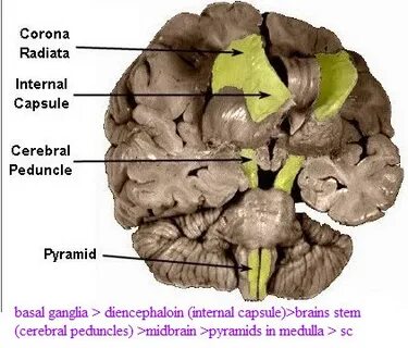 Internal 2