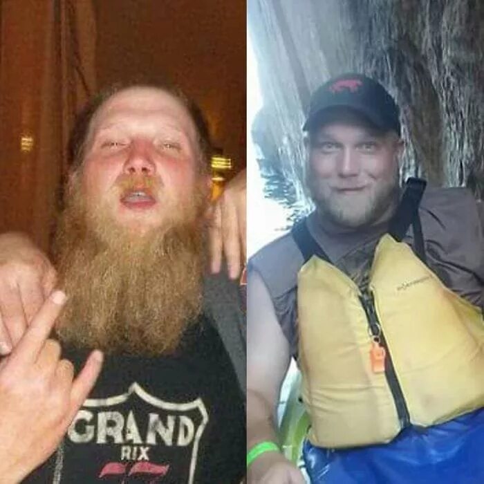 Алкоголь до и после фото.