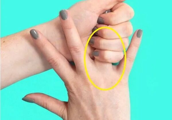 Немеет мизинец на левой руке. Как лечить безымянным пальцем. Как лечить безымянным пальцем. Как лечить безымянным пальцем. Немеет мизинец на левой руке причины.