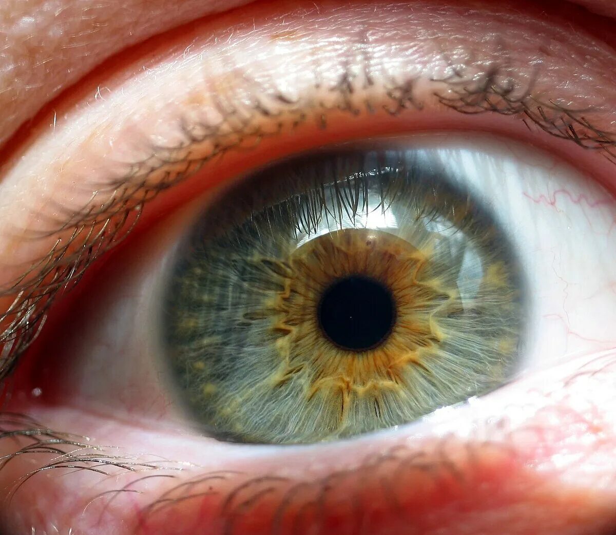 Почему желтым цветом глаз. Центральная гетерохромия зрачок. Центральная гетерохромия глаз Карий и зеленый. Гетерохромный иридоциклит Фукса. Центральная гетерохромия карих глаз.