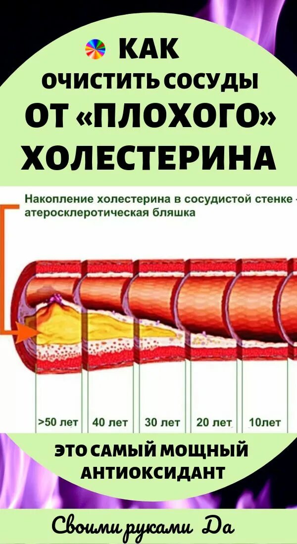 Очищение сосудов от холестерина. Препараты для очистки сосудов от холестериновых бляшек. Чистка артерий от холестерина. Очистка сосудов от холестериновых отложений. Как очистить сосуды от холестериновых тромбов