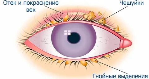 Отек белок