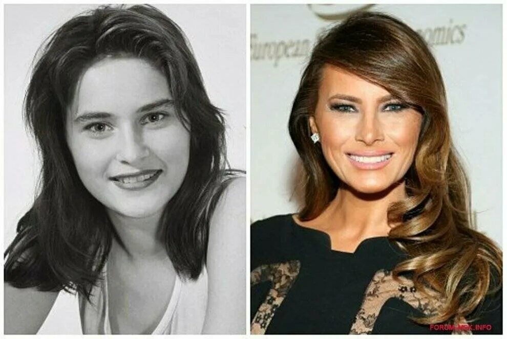 Мелания трамп возраст до и после пластики Melanija Tramp Pre I Posle Plastičnih Operacija YouTube