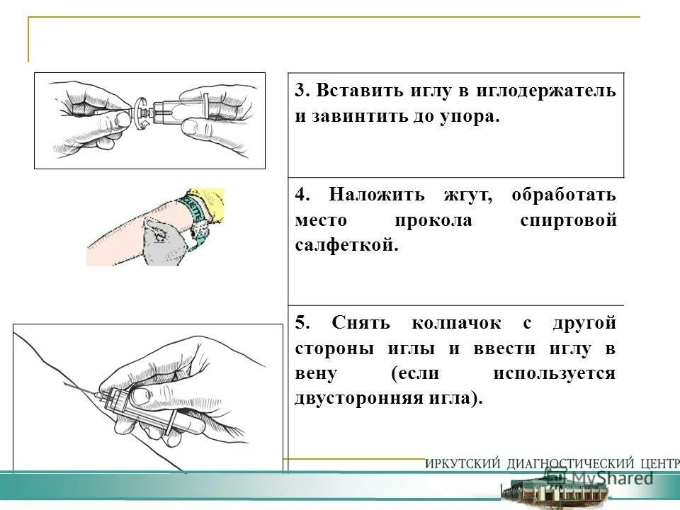 Иглы для швейной машинки чайка 142м. Вставить иглу. Швейная машинка пмз схема иглы. Схемаустановкт иглы в швейную машинку. Нитевдеватель family 2347.