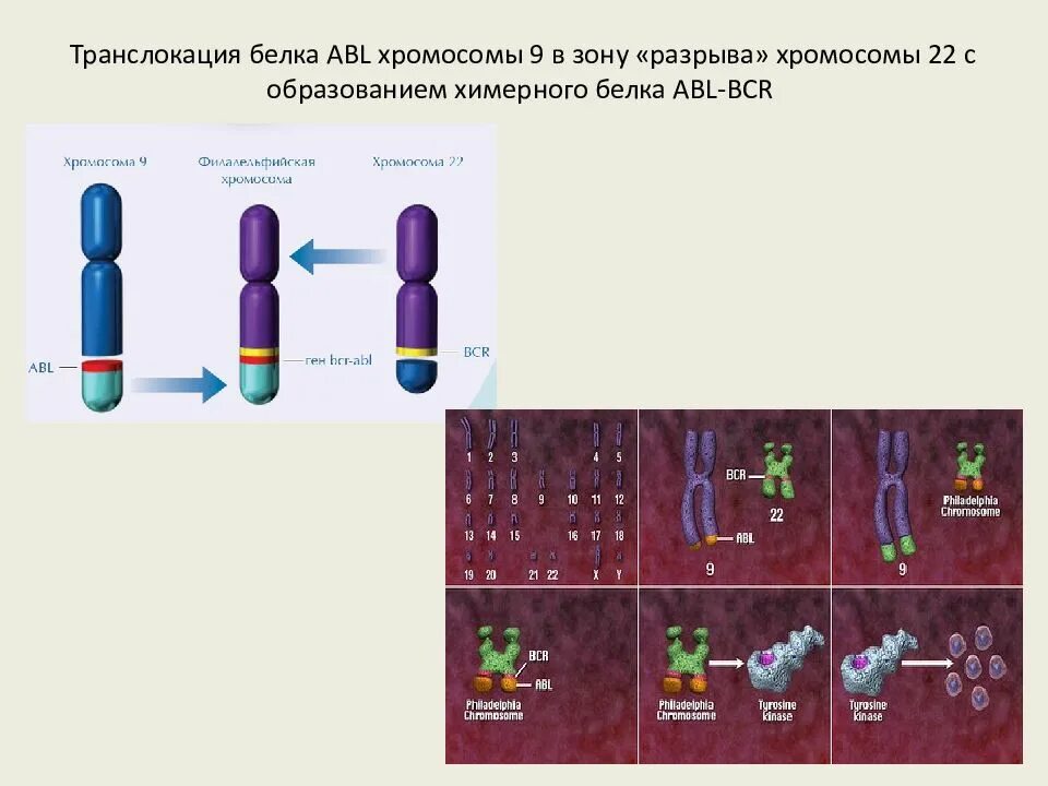 Носителем транслокации