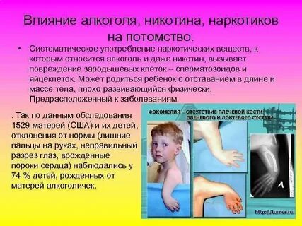Систематическое воздействие на развитие ребенка