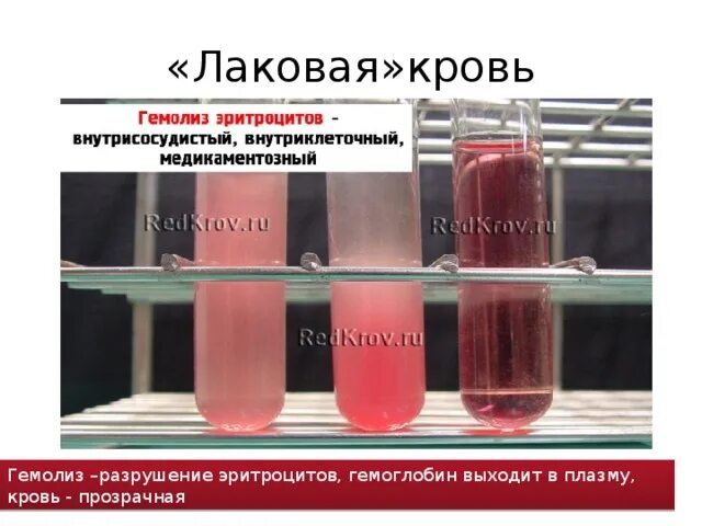 Хилез и гемолиз. 1. Что такое гемолиз?. Признак гемолизированной крови плазма. Гемолиз эритроцитов лаковая кровь. Резистентность крови