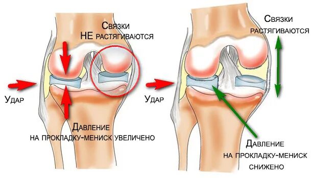 Связки мениска коленного сустава. Строение менисков коленного сустава.