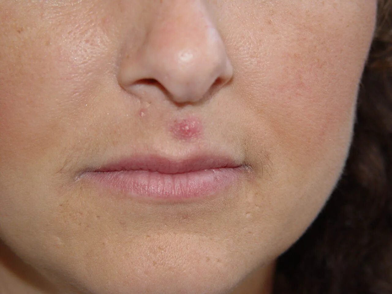 Could gene editing eliminate the herpes virus? Fox News
