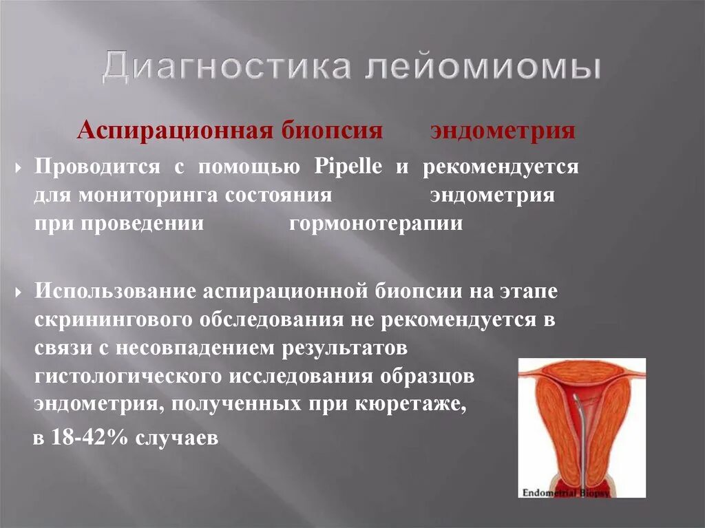 Лечить лейомиому