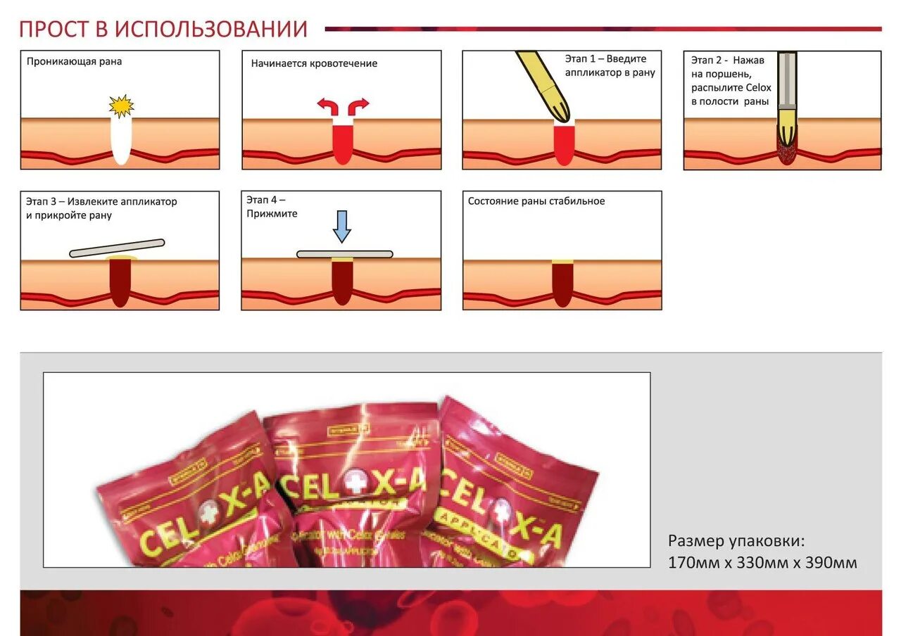 Celox аппликатор. Целокс для остановки кровотечения. Celox остановка кровотечения. Аппликатор Celox-a в ране.
