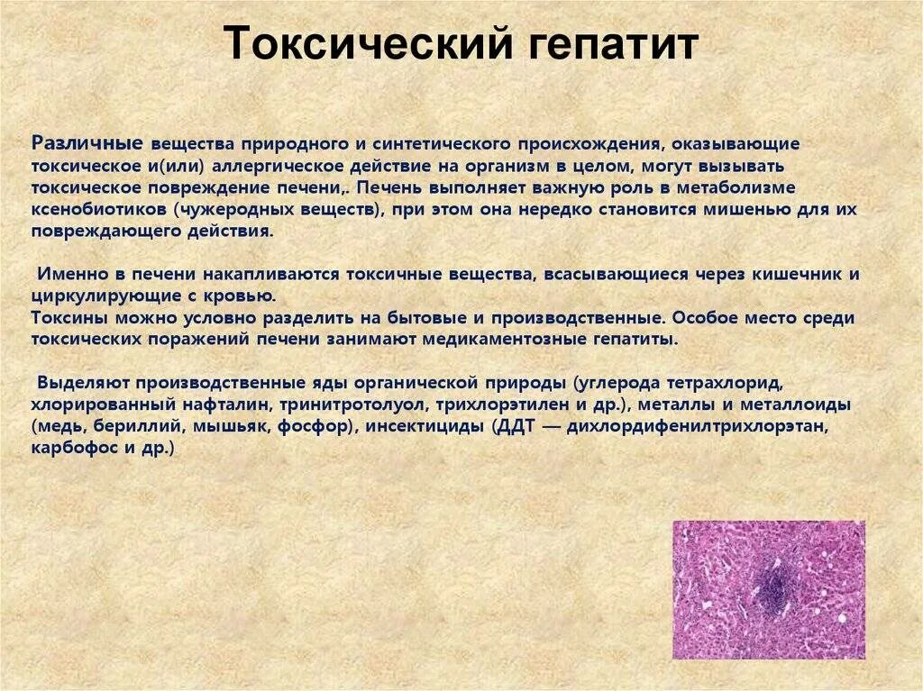 Токсический гепатит симптомы. Токсический лекарственный гепатит. Токсический гепатит этиология. Токсические поражения печени. Токсические поражения печени.. Токсичное токсическое