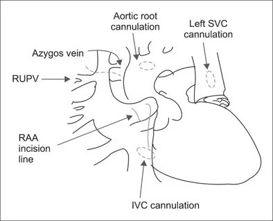 Cardioplegia латынь