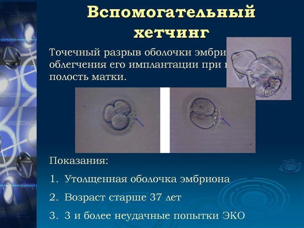 Эмбрион при эко. Хетчинг эмбрионов. рассечение оболочки эмбриона вспомогательный хетчинг. хэтчинг эмбриона что это. вспомогательный хетчинг.