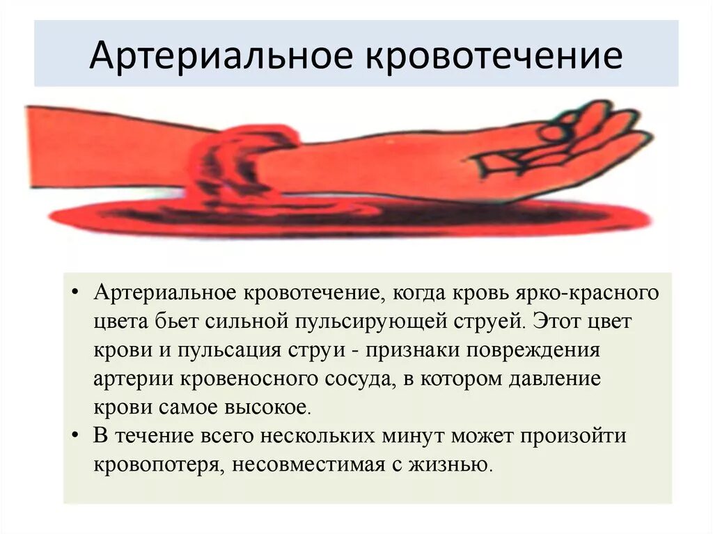 Ярко красный цвет крови является признаком. Артериальное кровотечение. Артериальное кровотечение цвет. Венозное и артериальное кровотечение цвет.