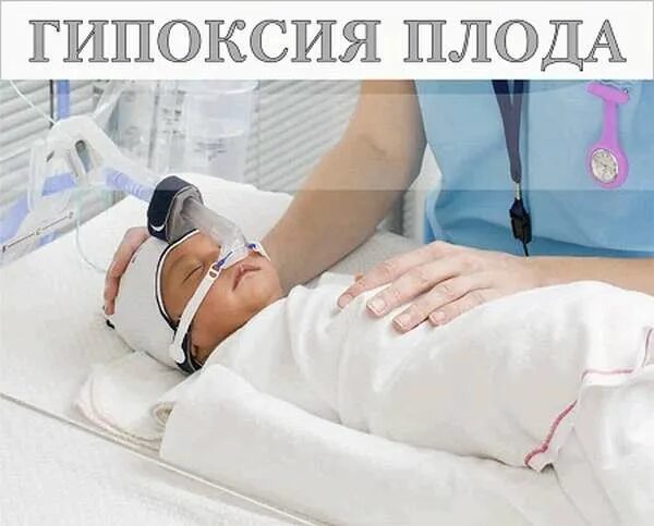 Гипоксия плода и асфиксия новорожденного. Острая и хроническая гипоксия плода. Профилактика гипоксии плода при беременности препараты. Гипоксия 37 недель. Группы риска гипоксии плода.