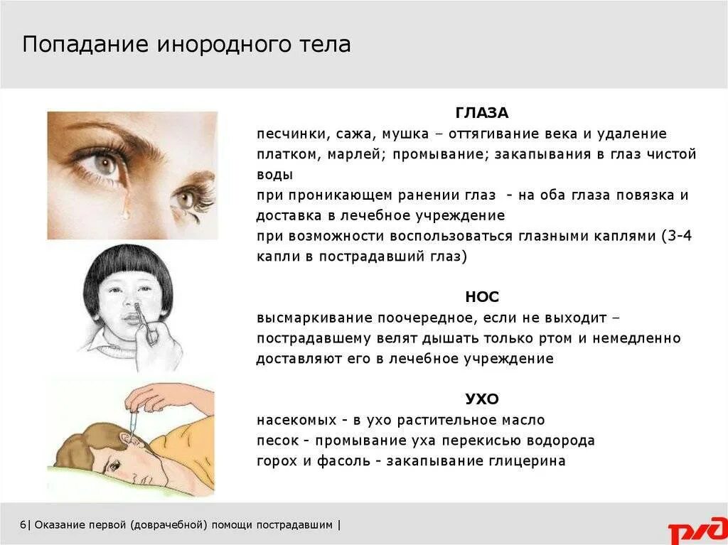 Помощь при инородном теле в глазу. Оказание первой помощи при попадании инородного тела в ухо. Порядок оказания первой помощи при попадании инородного тела в глаз. Первая помощь при попадании инородного тела в нос. Первая помощь ребенку при попадании инородного тела в глаз.