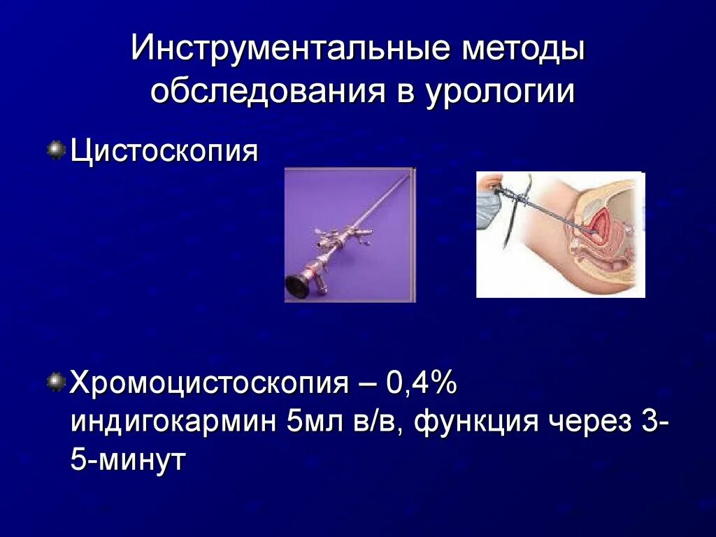 Обследование урологии. Инструментальные методы обследования. Методы обследования в урологии. Методика обследования урологических больных.