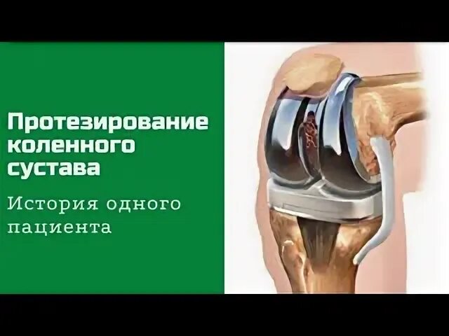Протезирование коленного сустава сколько заживает
