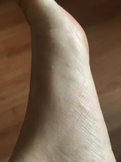 Периодически небольшое