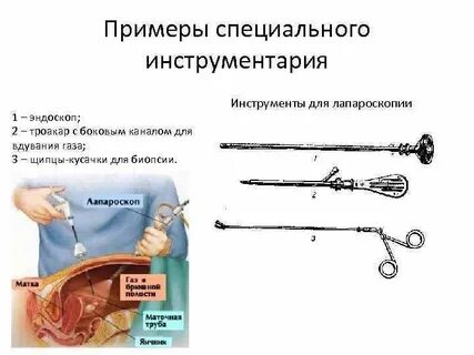 Когда снимают чулки после операции лапароскопии