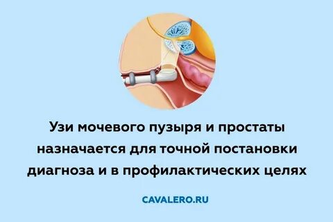Как делают узи простаты у мужчин видео