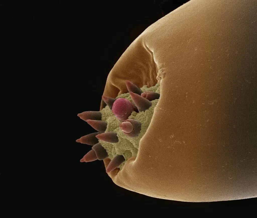 Увеличение больших половых. Женский сосок под микроскопом. Сосок подимикроскопом. Головка под микроскопом.