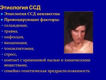 Системная склеродермия клинические