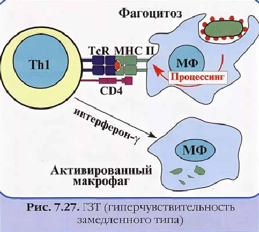 Гзт для мужчин купить. Механизм реакция ГЗТ схема. Гиперчувствительность замедленного типа схема. Реакция гиперчувствительности замедленного типа. Механизм гиперчувствительности замедленного типа.