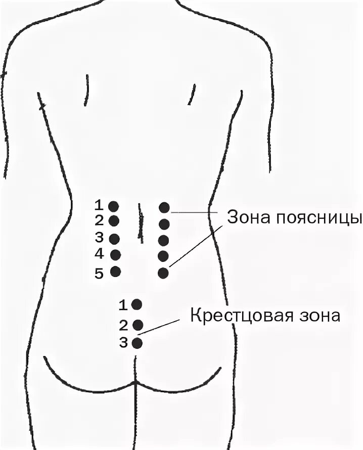 Зона поясницы. Массаж пояснично-крестцового отдела схема. Постановка пиявок на крестец и копчик схема. Массаж пояснично крестцовой зоны. Болевые точки поясничного отдела позвоночника.