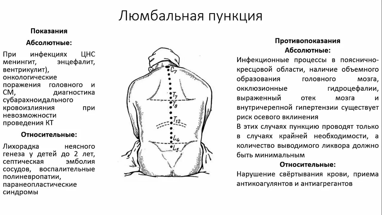 Спинномозговая пункция алгоритм. Техника проведения люмбальной пункции алгоритм. методика проведения люмбальной пункции. алгоритм проведения люмбальной пункции неврология. положение пациента при спинномозговой пункции.