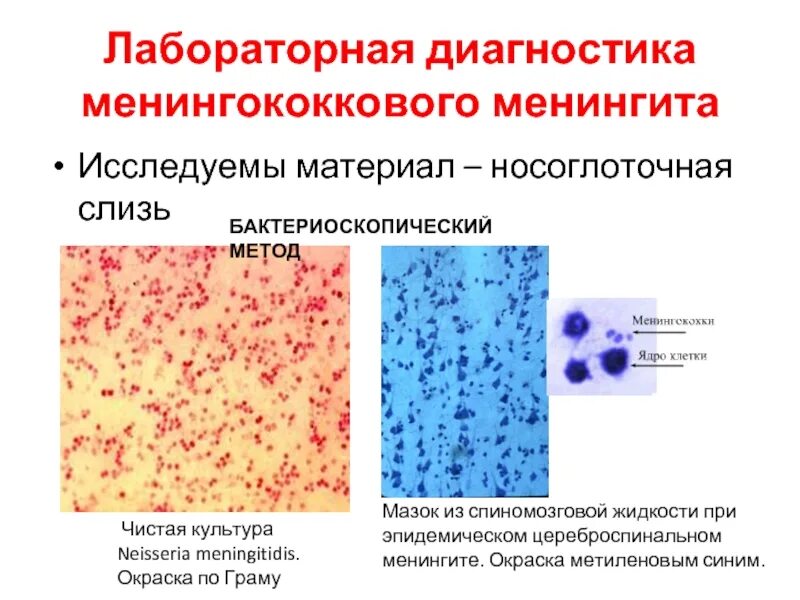 Диагностика менингококкового менингита. Лабораторная диагностика менингококковой инфекции. Окраска гонококков метиленовым синим. Гонорея микроскопия метиленовый синий. Бифидобактерии окраска метиленовым синим.