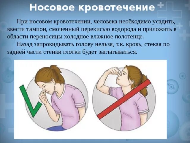 Что делать при кровотечении из носа. При кровотечении из носа нельзя. что нельзя делать при носовом кровотечении. что нельзя делать при кровотечении из носа. при носовом кровотечении рекомендуется.