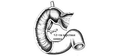 12 ти перстная кишка