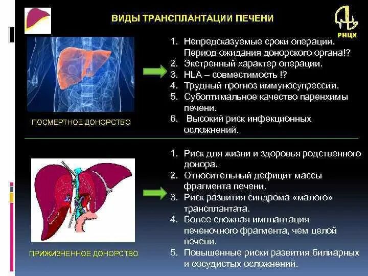 Пересадка печени стоимость. Трансплантация печени. Виды трансплантации печени. Ортотопическая трансплантация печени. Трансплантация печени Оперативная хирургия.