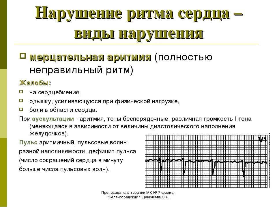 Что делать при тахикардии в домашних условиях. Мерцательная аритмия и фибрилляция предсердий. Мерцательная аритмия характеристика пульса. Причины мерцательной аритмии предсердий. Мерцательная аритмия симптомы аускультации.