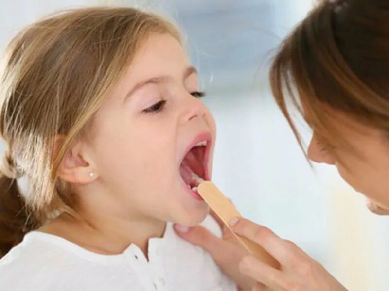 Хронический тонзиллит у детей. Как помочь ребенку при ангине. Клинические проявления фарингита у детей. Фарингит зев гиперемирован. Как помочь ребенку при ангине.