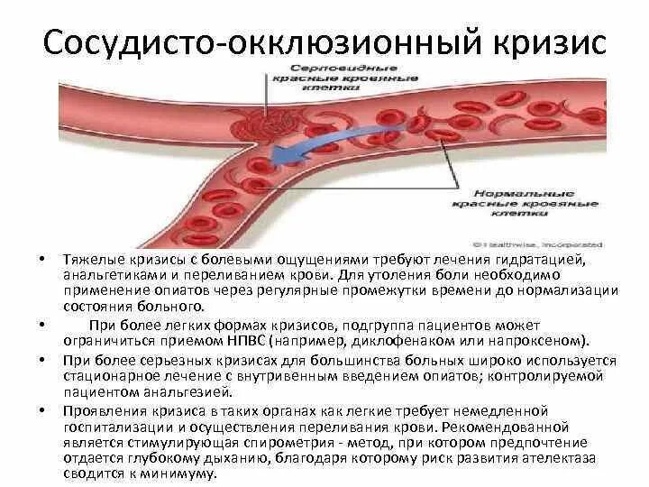 Серповидноклеточная анемия какая. Серповидноклеточная анемия. Серповидноклеточная анемия этиология. Клеточная анемия серповидноклеточная.
