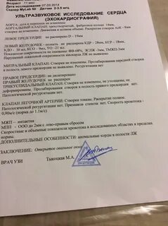 Узи сердца что показывает стоит ли делать