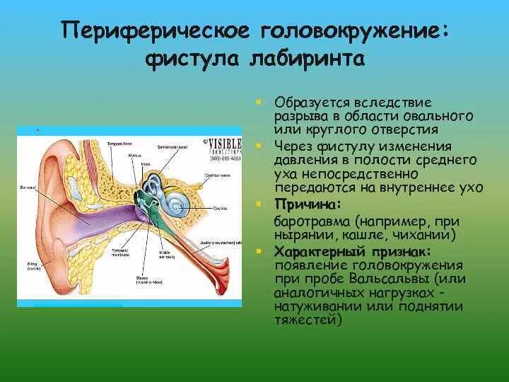 Давление в среднем ухе атмосферное. Перилимфатическая фистула Лабиринта. Перилимфатическая фистула. Кристаллики в среднем ухе. Кристаллы в среднем ухе.