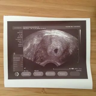 Через 1.5 недели