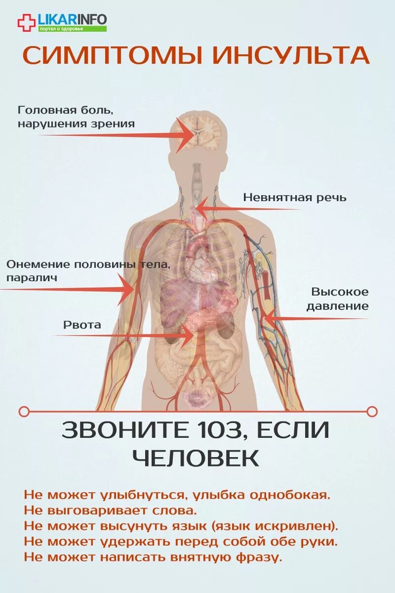 Ломота и слабость в теле без температуры. Инсульт симптомы. Признаки инсульта. Инфаркт симптомы. Инфаркт миокарда симптомы.