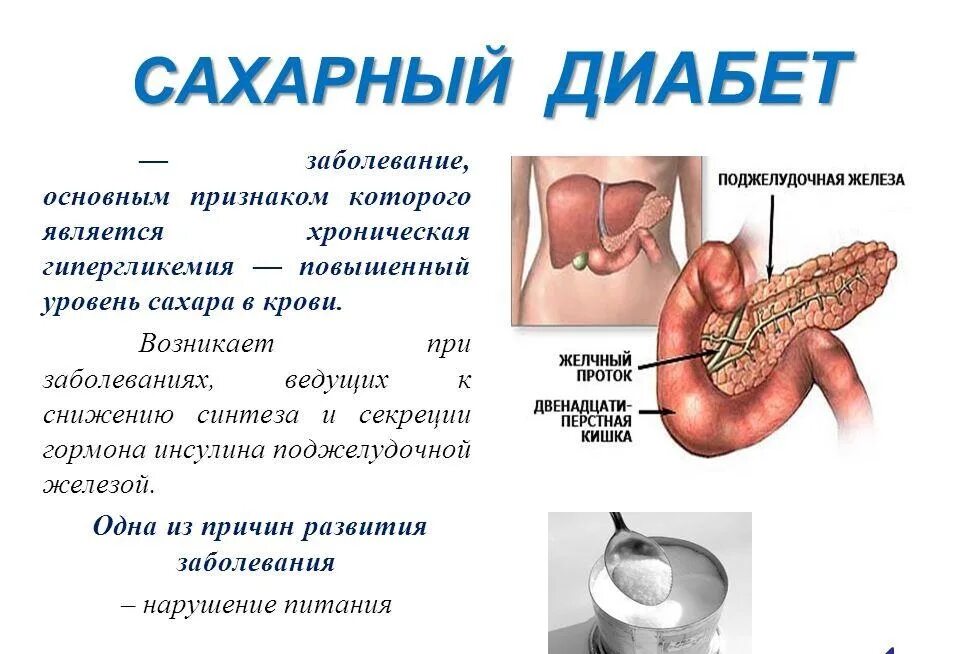 Нарушения при сахарном диабете. Сахарный диабет. сахарный диабет патология. органы мишени при сахарном диабете.