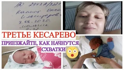 Второе кесарево во сколько недель