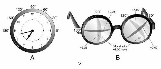 Ось цилиндрической линзы. 5. Сфера и цилиндр в офтальмологии. Строение торических контактных линз. Сфера цилиндр очки.