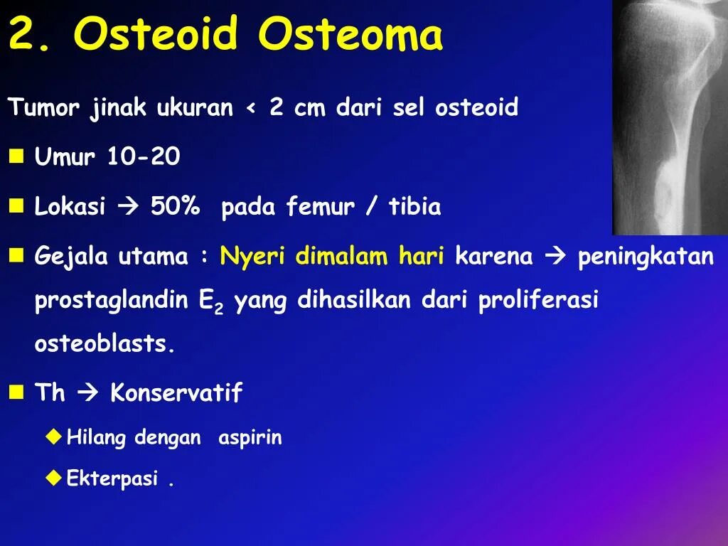 Воспаление латынь терминоэлемент. Osteoma терминоэлементы латынь. Остеома грудной клетки. Рентгенография латынь терминоэлемент. Osteoid between the osteoblast layer.