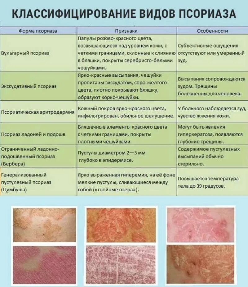 Всореаз. Кожные заболевания таблица. Сыпь отличия